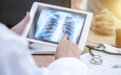 Beneficios de la Telemedicina