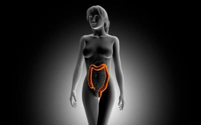 Conoce el síndrome del intestino irritable