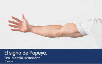 SIGNO DE POPEYE: