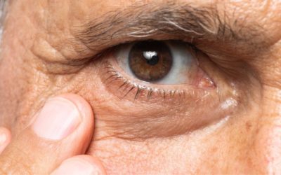 La Degeneración Macular Asociada con la Edad